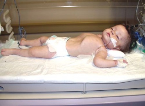 OLMAZBOYLEVAHSET olmazboylevahsethaberi