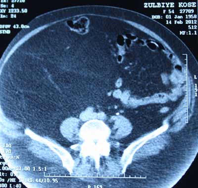 urresmisulbiye ur15kilo