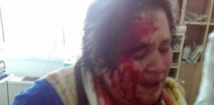 gorelekadinasiddetgiresun